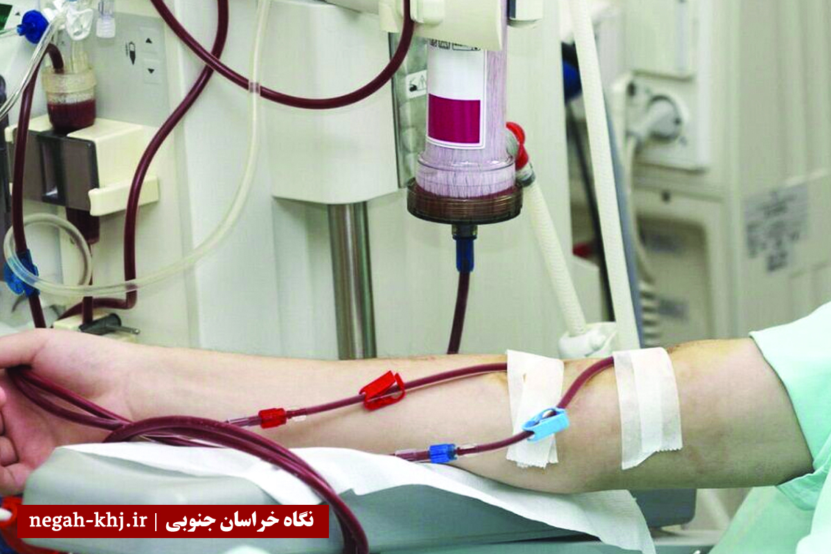 دیالیز